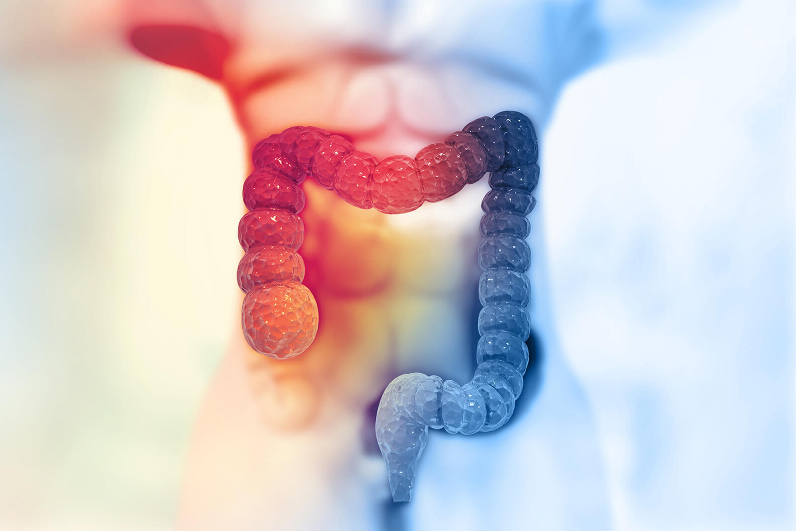 Colorectal Cancers