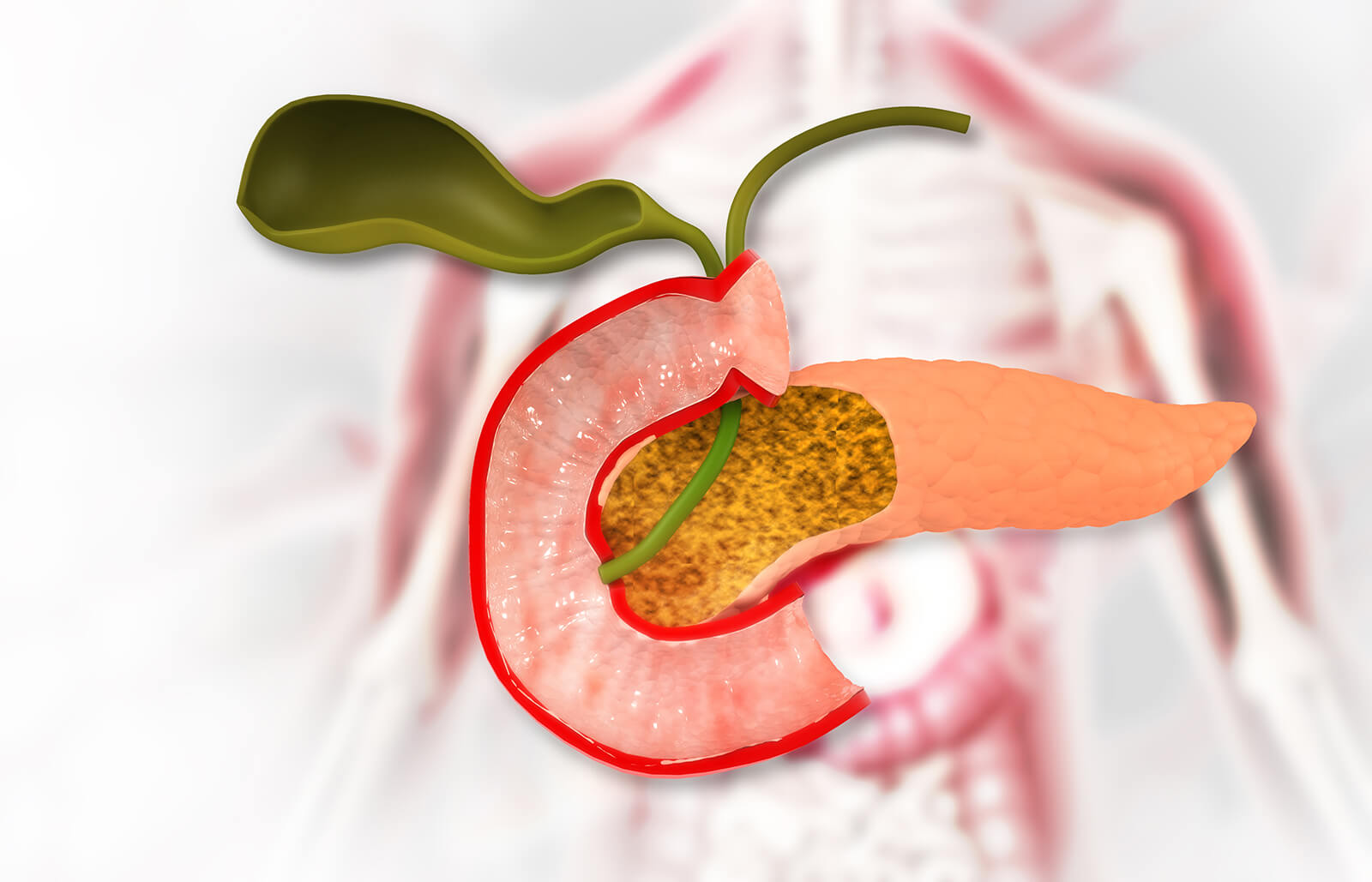 Hepato Biliary Pancreatic Cancers